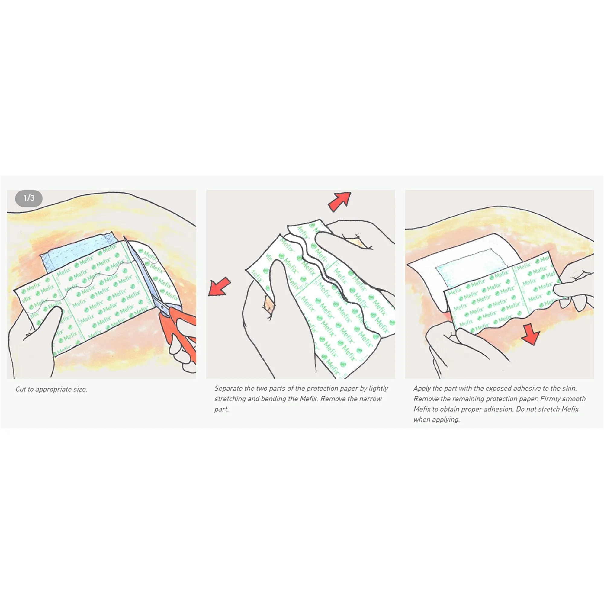 Mefix® Nonwoven Dressing Retention Tape, 2 Inch x 11 Yard